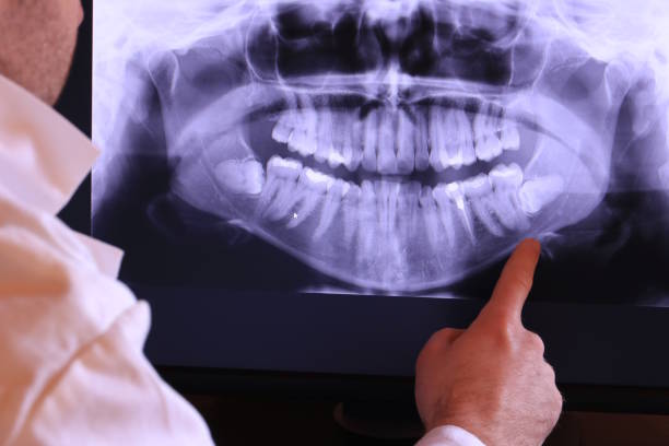 Best Emergency Broken Tooth Repair in Oro Valley, AZ